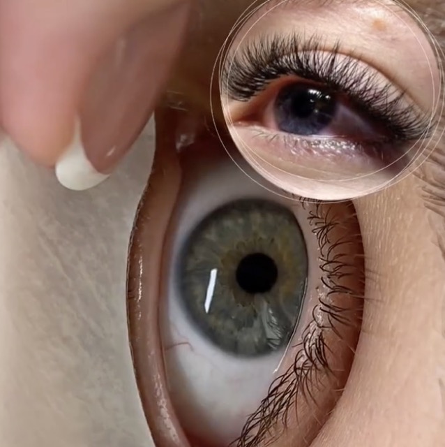 Превью видео